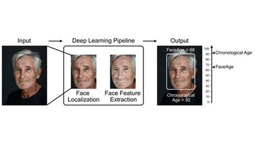 얼굴 사진으로 생물학적 나이 추정-암 예후 예측하는 AI '페이스에이지' (사진=Mass General Brigham 제공)