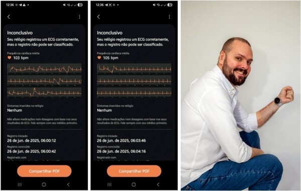 갈라르트의 심전도 측정 데이터와 갤럭시 워치를 착용한 모습. 사진=삼성전자 중남미 총괄 제공